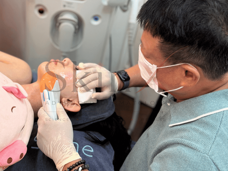 HIFU dòng côn nghệ trẻ hóa phù hợp với nhiều đối tượng